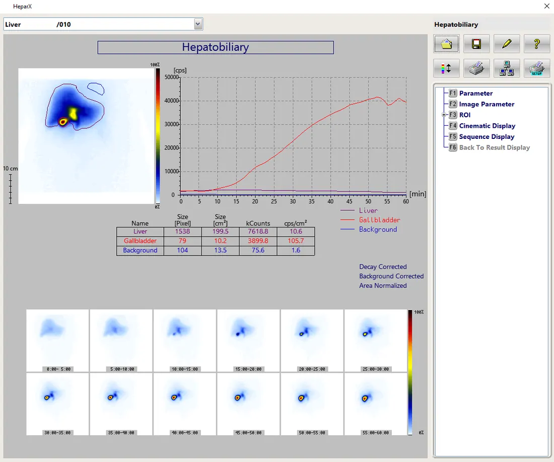Hepatobiliary Scintigraphy and Gastric Emptying
