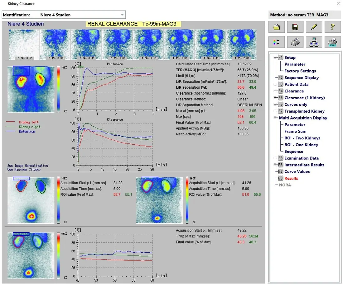 Kidney - TER, GFR and ERPF calculation