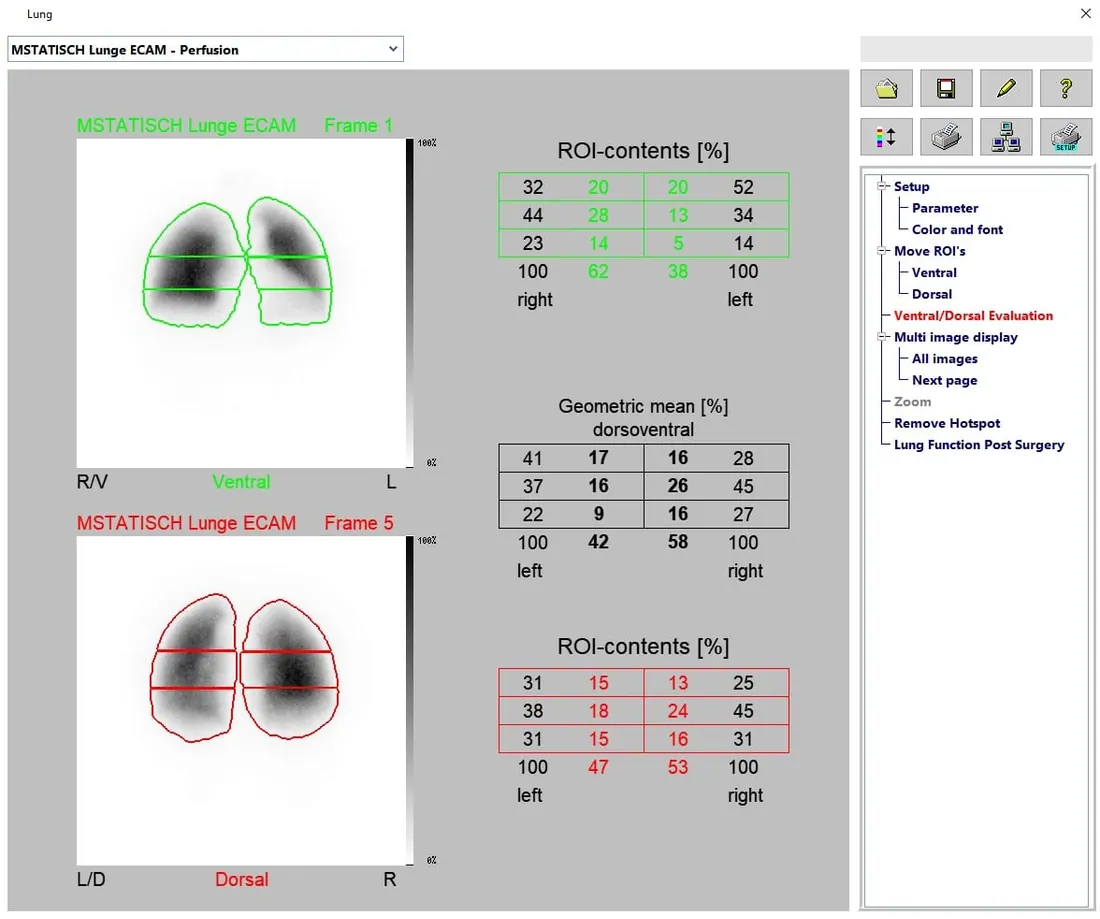 Lung - Quantification