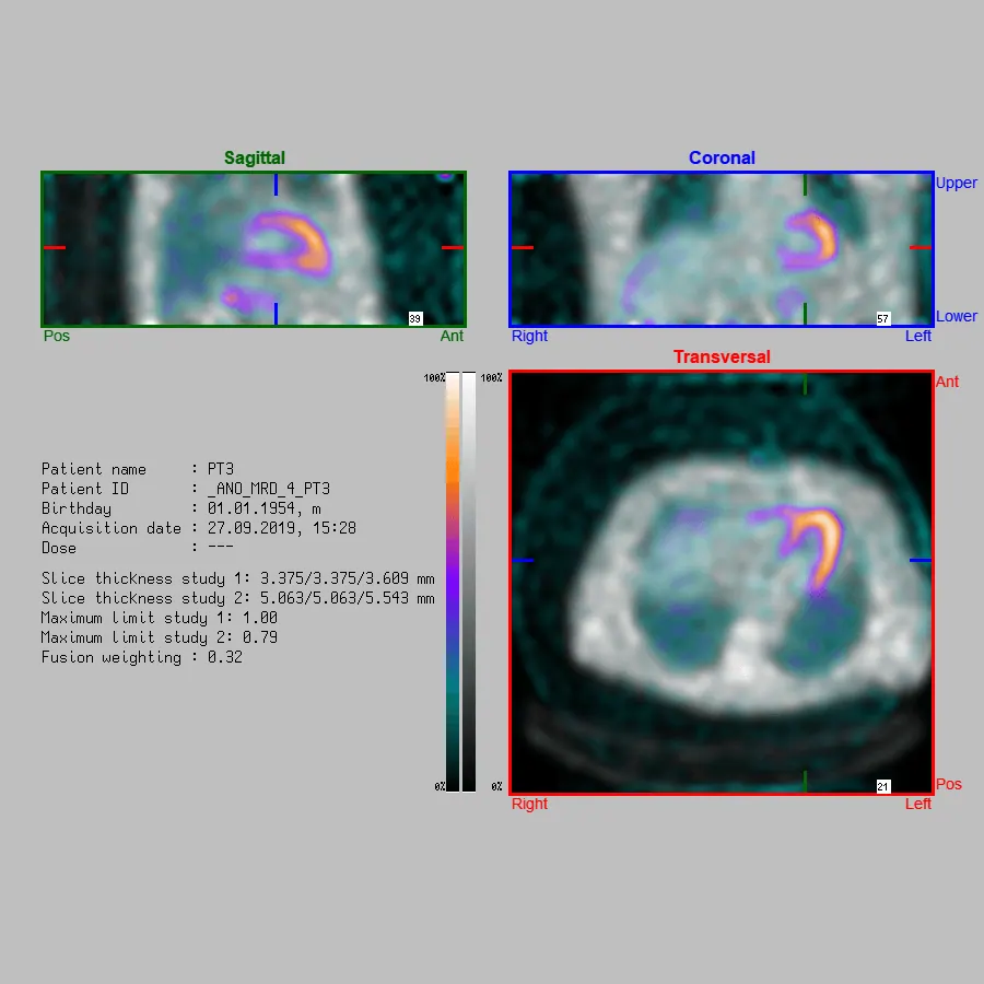 Cardiac Matching Application