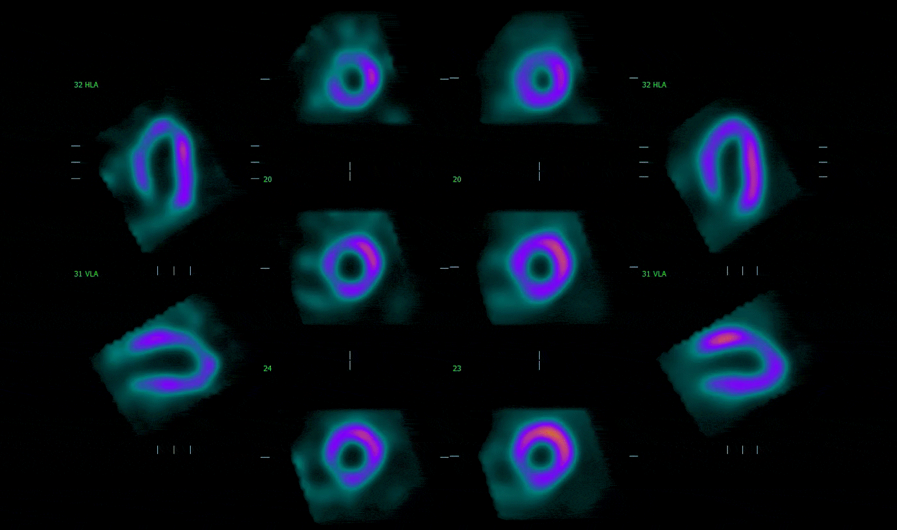TruClear.AI Noise Reduction. Manufacturer TruClear.AI software demonstration.