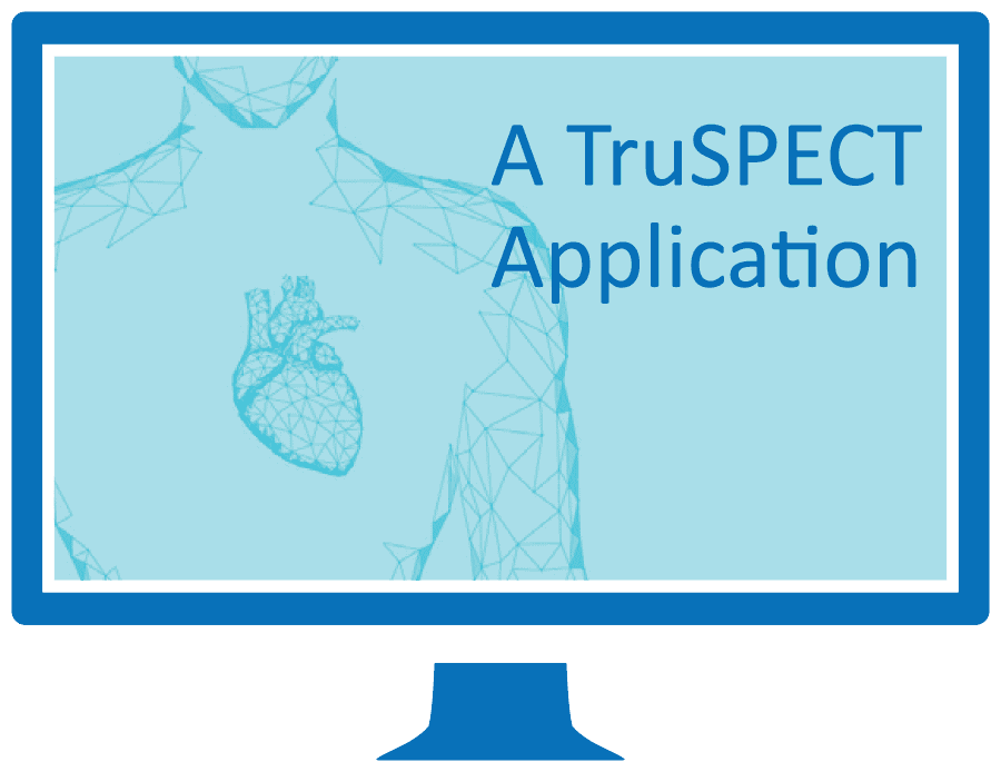 TruSPECT Workstation. Manufacturer TruSPECT workstation illustration.