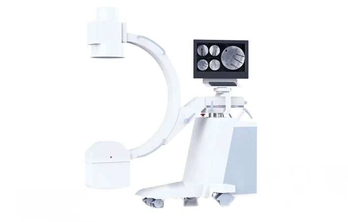 Perlove PLX116B1 Mobile C-arm. Manufacturer family image; confirm the selected configuration.